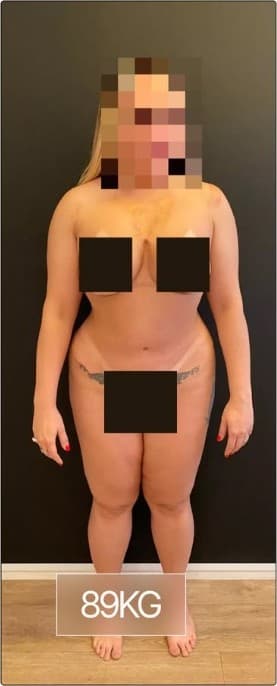 Registro fotográfico do acompanhamento, 89 kg