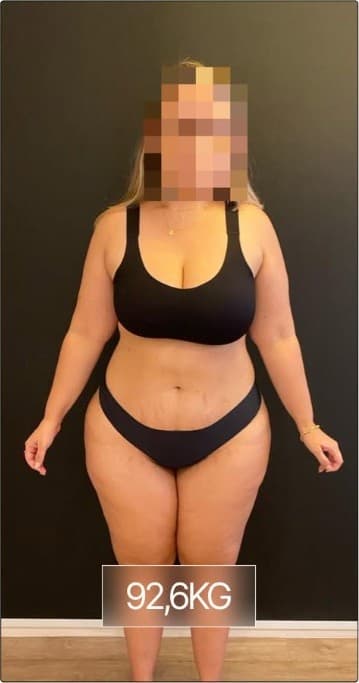 Registro fotográfico do acompanhamento, 92,6 kg
